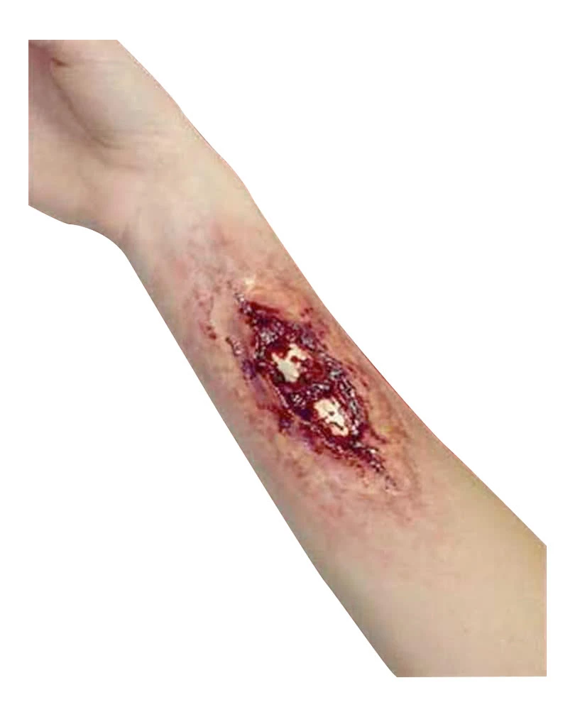 Knochenbruch / Broken Bone Wunde – Bild 2