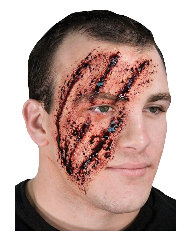 Schredder Wunde / Shredded